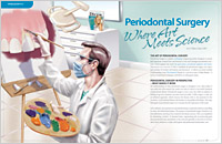 Periodontal Surgery - Dear Doctor Magazine